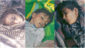 dead children yemen