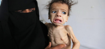 “Would you like a drink of water?”  Please Ask a Yemeni Child